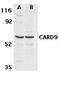 Caspase recruitment domain-containing protein 9 antibody, TA306093, Origene, Western Blot image 