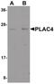 Placenta-specific protein 4 antibody, PA5-21047, Invitrogen Antibodies, Western Blot image 