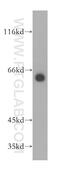 Wnt Ligand Secretion Mediator antibody, 17950-1-AP, Proteintech Group, Western Blot image 