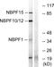 NBPF Member 1 antibody, GTX87305, GeneTex, Western Blot image 