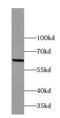 Zinc Finger Protein 18 antibody, FNab09662, FineTest, Western Blot image 