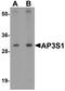 AP-3 complex subunit sigma-1 antibody, LS-C144389, Lifespan Biosciences, Western Blot image 