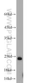 RAB6B, Member RAS Oncogene Family antibody, 10340-1-AP, Proteintech Group, Western Blot image 