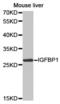 Insulin Like Growth Factor Binding Protein 1 antibody, TA327467, Origene, Western Blot image 