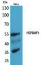 HSPB1 Associated Protein 1 antibody, A13002-2, Boster Biological Technology, Western Blot image 