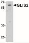 Zinc finger protein GLIS2 antibody, NBP2-41311, Novus Biologicals, Western Blot image 