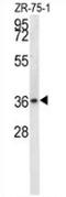 Nitrilase homolog 1 antibody, AP52880PU-N, Origene, Western Blot image 