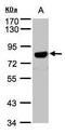 Amyloid Beta Precursor Protein antibody, TA308848, Origene, Western Blot image 