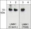 LIM domain kinase 1 antibody, LP1891, ECM Biosciences, Western Blot image 
