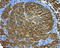 Melan-A antibody, LS-C796982, Lifespan Biosciences, Immunohistochemistry paraffin image 