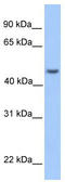 Ankyrin Repeat And SOCS Box Containing 6 antibody, TA337569, Origene, Western Blot image 