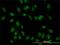 TATA-Box Binding Protein Associated Factor 11 antibody, H00006882-M01, Novus Biologicals, Immunocytochemistry image 