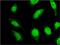 Uncharacterized protein C18orf23 antibody, MA5-23079, Invitrogen Antibodies, Immunofluorescence image 
