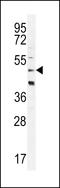 Corticotropin Releasing Hormone Receptor 2 antibody, LS-C167036, Lifespan Biosciences, Western Blot image 