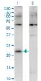 CKLF Like MARVEL Transmembrane Domain Containing 4 antibody, H00146223-M02, Novus Biologicals, Western Blot image 