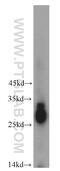 Crystallin Beta B3 antibody, 21009-1-AP, Proteintech Group, Western Blot image 