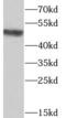 ST6 Beta-Galactoside Alpha-2,6-Sialyltransferase 1 antibody, FNab08269, FineTest, Western Blot image 