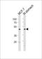HNF-3B antibody, MBS9208947, MyBioSource, Western Blot image 