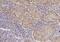 V-set domain-containing T-cell activation inhibitor 1 antibody, A02821-3, Boster Biological Technology, Immunohistochemistry frozen image 