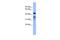 RNA Binding Fox-1 Homolog 2 antibody, GTX47400, GeneTex, Western Blot image 