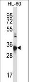 C-C chemokine receptor type 10 antibody, LS-C168489, Lifespan Biosciences, Western Blot image 
