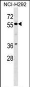 Zinc Finger Protein 512 antibody, PA5-71944, Invitrogen Antibodies, Western Blot image 