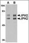 Junctophilin 2 antibody, orb89232, Biorbyt, Western Blot image 