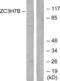 Zinc Finger CCCH-Type Containing 7B antibody, abx013832, Abbexa, Western Blot image 