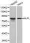 Alkaline Phosphatase, Biomineralization Associated antibody, LS-C192354, Lifespan Biosciences, Western Blot image 