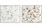 Tumor Protein P63 antibody, 4981S, Cell Signaling Technology, Immunohistochemistry paraffin image 