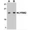 LYR Motif Containing 2 antibody, MBS150277, MyBioSource, Western Blot image 