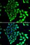 Fanconi anemia group J protein antibody, orb373480, Biorbyt, Immunofluorescence image 