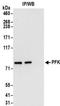 Phosphofructokinase, Muscle antibody, NBP2-32169, Novus Biologicals, Immunoprecipitation image 