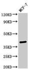 Secreted frizzled-related protein 4 antibody, CSB-PA021140LA01HU, Cusabio, Western Blot image 