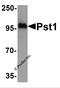 ST8 Alpha-N-Acetyl-Neuraminide Alpha-2,8-Sialyltransferase 4 antibody, 3825, ProSci, Western Blot image 