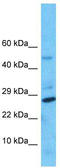 Nudix Hydrolase 8 antibody, TA337475, Origene, Western Blot image 