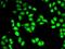 Proteasome 26S Subunit, ATPase 3 antibody, orb154153, Biorbyt, Immunofluorescence image 