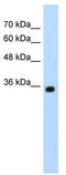 Zinc Finger MYND-Type Containing 11 antibody, TA337299, Origene, Western Blot image 