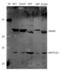 Methyltransferase Like 23 antibody, DZ41142, Boster Biological Technology, Western Blot image 