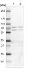 UPF3B Regulator Of Nonsense Mediated MRNA Decay antibody, PA5-51652, Invitrogen Antibodies, Western Blot image 