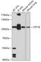 Carnitine Palmitoyltransferase 1B antibody, GTX64535, GeneTex, Western Blot image 