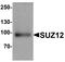 Polycomb protein SUZ12 antibody, LS-B10186, Lifespan Biosciences, Western Blot image 