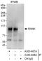 CD265 antibody, A303-808A, Bethyl Labs, Immunoprecipitation image 