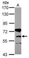 Carnitine Palmitoyltransferase 1B antibody, GTX117231, GeneTex, Western Blot image 