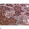 Fms Related Tyrosine Kinase 4 antibody, LS-C813851, Lifespan Biosciences, Immunohistochemistry paraffin image 
