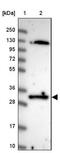 LRAT Domain Containing 1 antibody, NBP2-14006, Novus Biologicals, Western Blot image 
