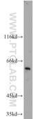Solute Carrier Family 47 Member 1 antibody, 20898-1-AP, Proteintech Group, Western Blot image 