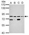 Kelch Like Family Member 1 antibody, GTX117085, GeneTex, Western Blot image 