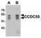 Nuclear Speckle Splicing Regulatory Protein 1 antibody, TA320043, Origene, Western Blot image 
