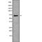 Pre-MRNA Processing Factor 38B antibody, PA5-68280, Invitrogen Antibodies, Western Blot image 